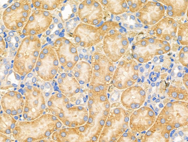 MARK3 Antibody in Immunohistochemistry (Paraffin) (IHC (P))