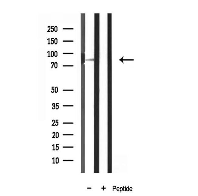 MARK3 Antibody in Western Blot (WB)