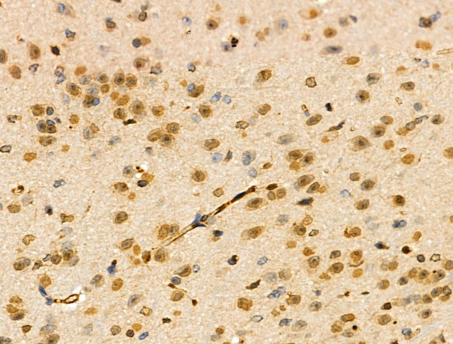 TEAD1 Antibody in Immunohistochemistry (Paraffin) (IHC (P))