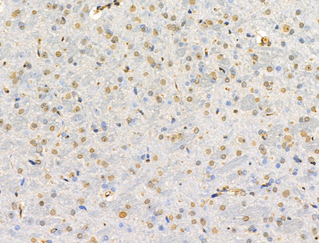 TEAD1 Antibody in Immunohistochemistry (Paraffin) (IHC (P))