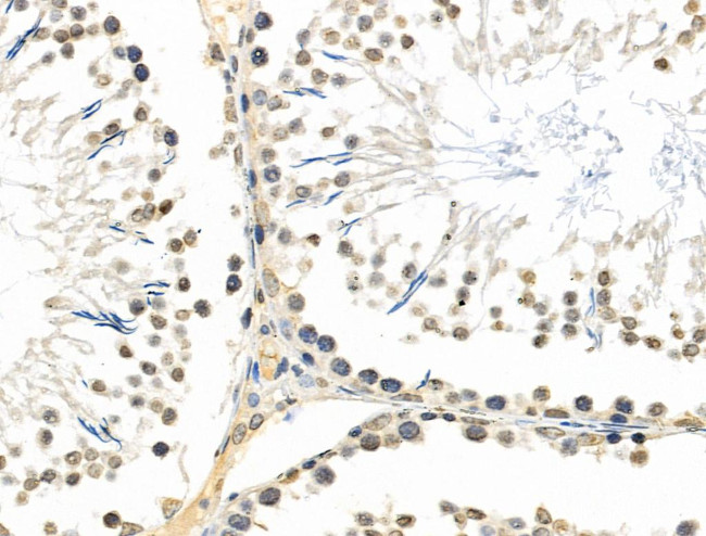 TEAD1 Antibody in Immunohistochemistry (Paraffin) (IHC (P))