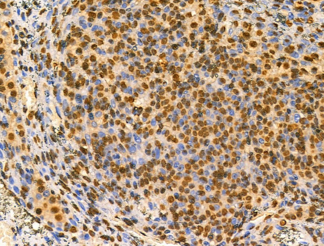 MZF1 Antibody in Immunohistochemistry (Paraffin) (IHC (P))