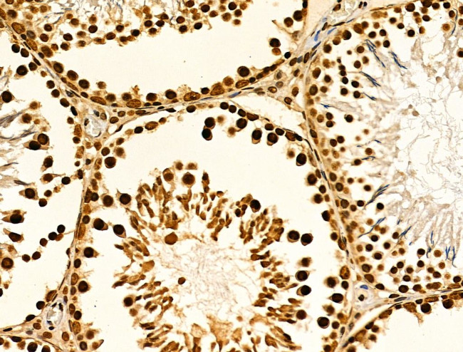 MZF1 Antibody in Immunohistochemistry (Paraffin) (IHC (P))