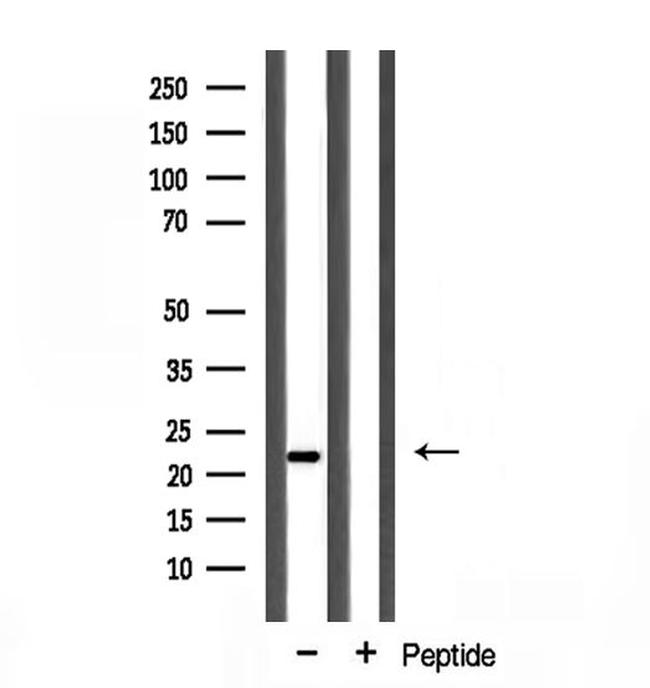 Cyclophilin F Antibody in Western Blot (WB)