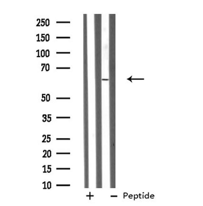 GRK4 Antibody in Western Blot (WB)