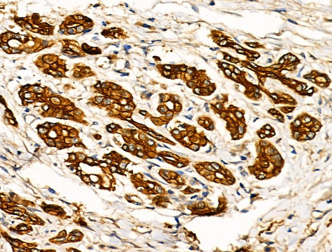 GRK5 Antibody in Immunohistochemistry (Paraffin) (IHC (P))