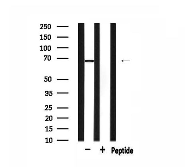 GRK5 Antibody in Western Blot (WB)