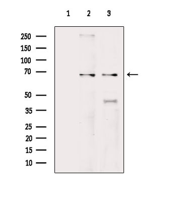 GRK5 Antibody in Western Blot (WB)