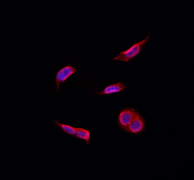 Recoverin Antibody in Immunocytochemistry (ICC/IF)