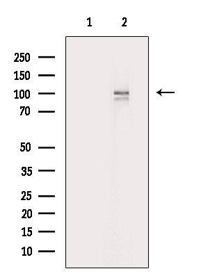 alpha Actinin 2/3 Antibody in Western Blot (WB)