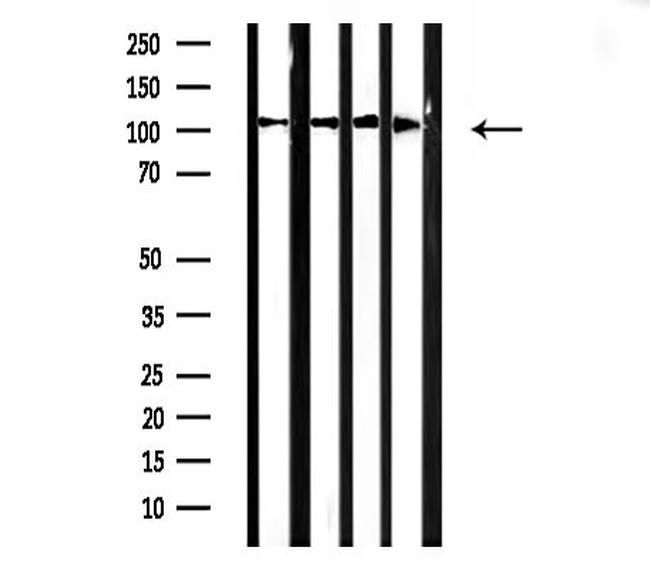 alpha Actinin 2/3 Antibody in Western Blot (WB)