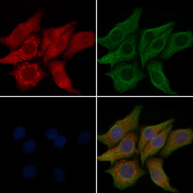 PHKA1/PHKA2 Antibody in Immunocytochemistry (ICC/IF)