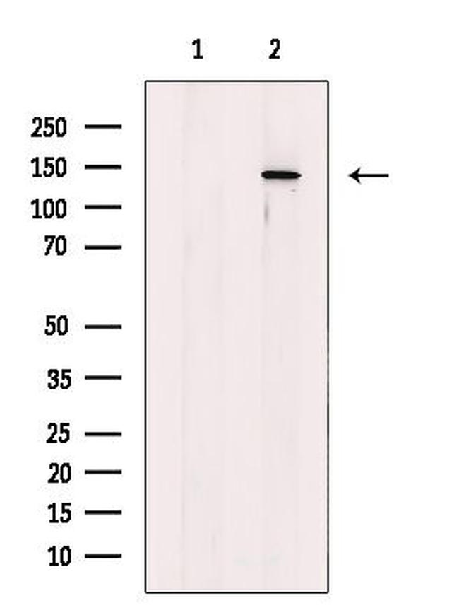 PHKA1/PHKA2 Antibody in Western Blot (WB)