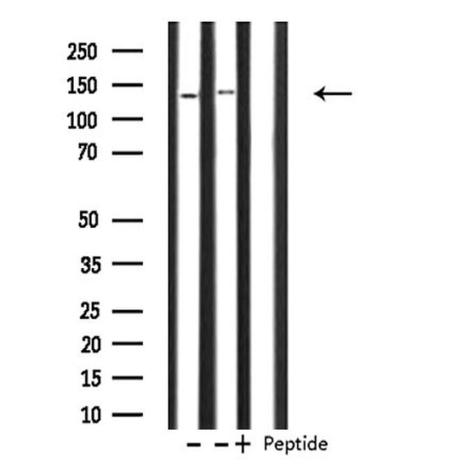 PHKA1/PHKA2 Antibody in Western Blot (WB)