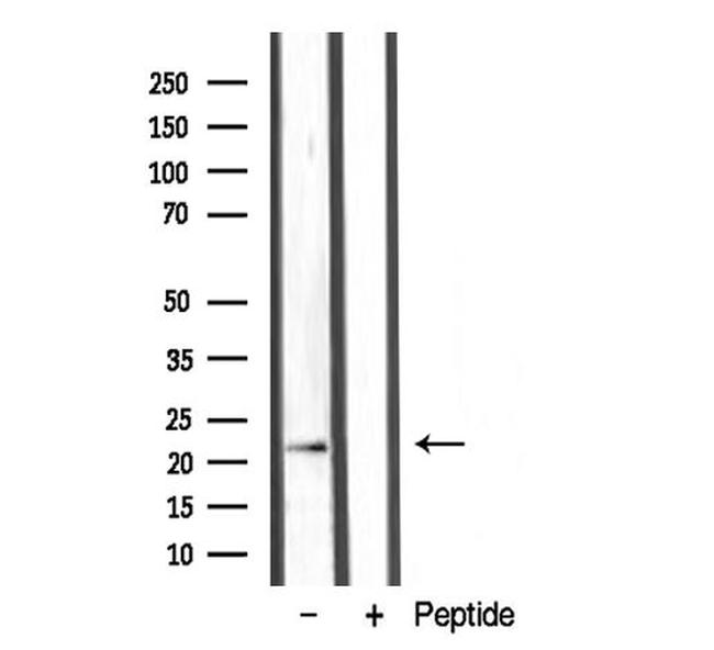 LTB Antibody in Western Blot (WB)