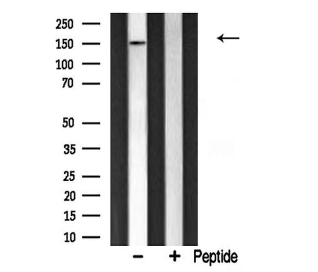 CHAF1A Antibody in Western Blot (WB)