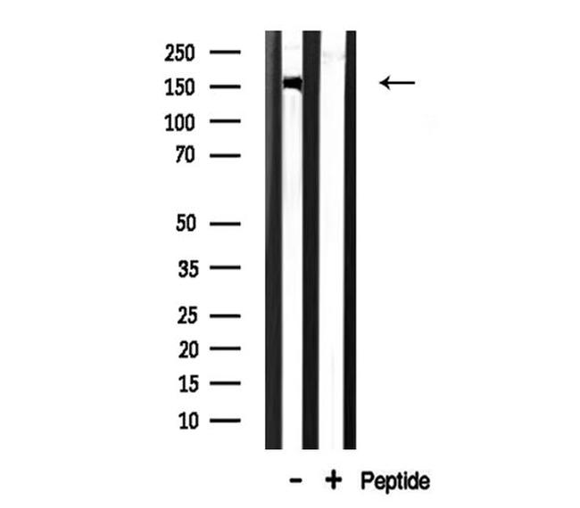 CHAF1A Antibody in Western Blot (WB)