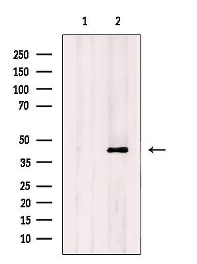 PDGFRL Antibody in Western Blot (WB)