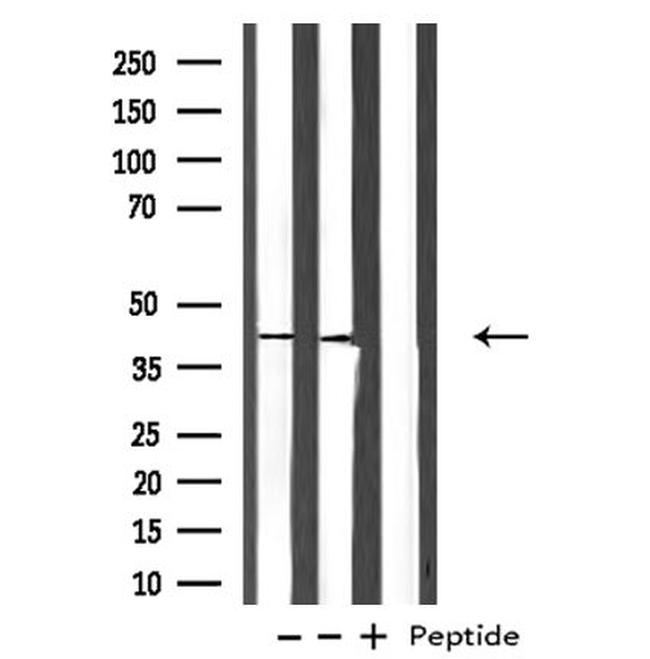 PDGFRL Antibody in Western Blot (WB)