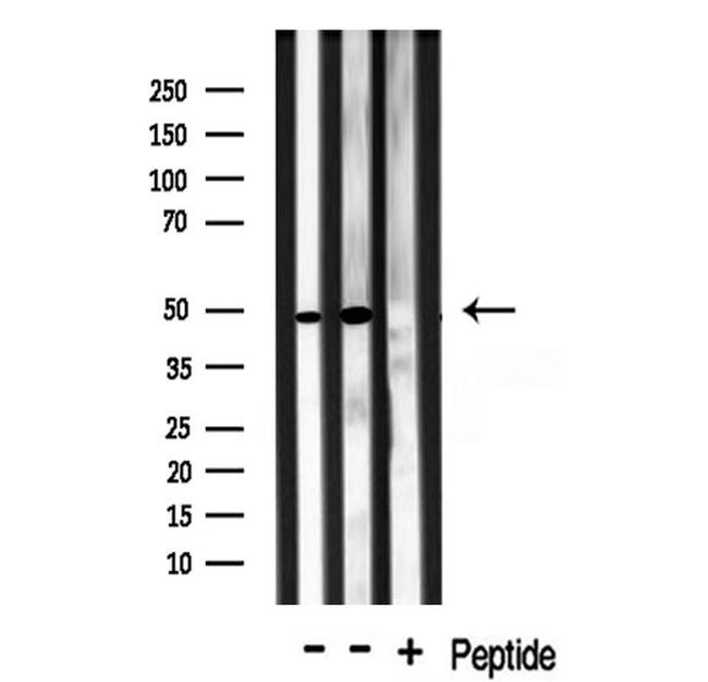 TRIP13 Antibody in Western Blot (WB)