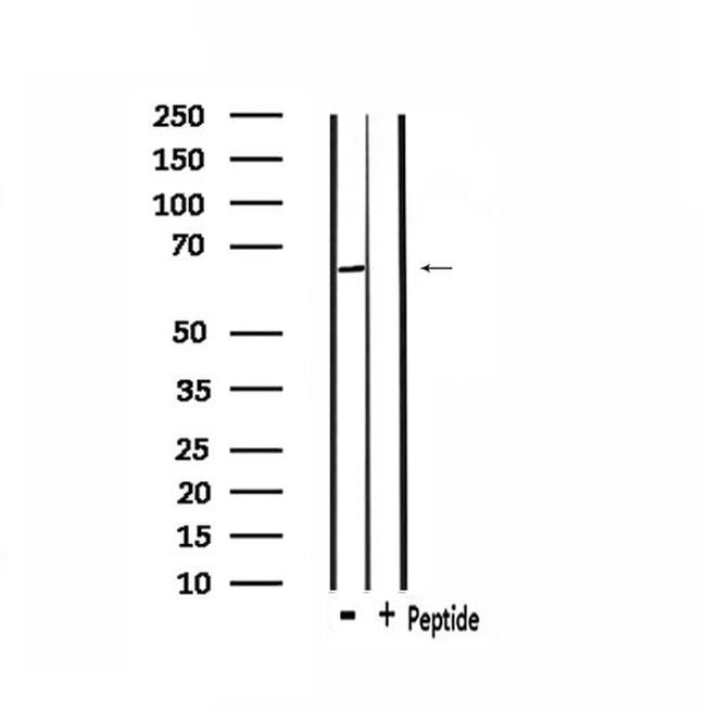 ADCK5 Antibody in Western Blot (WB)