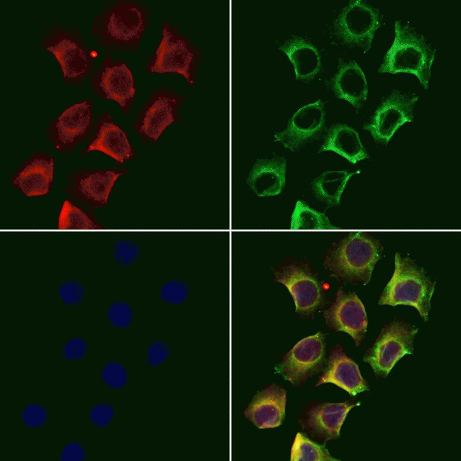 MARK2 Antibody in Immunocytochemistry (ICC/IF)