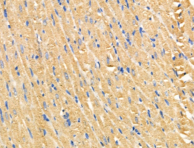 MARK2 Antibody in Immunohistochemistry (Paraffin) (IHC (P))