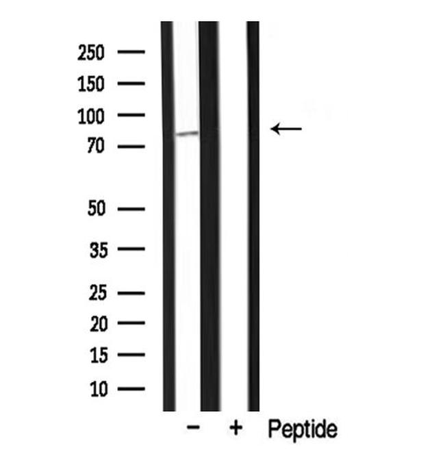 MARK2 Antibody in Western Blot (WB)