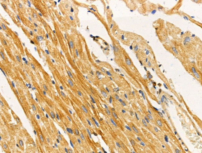 TUSC5 Antibody in Immunohistochemistry (Paraffin) (IHC (P))