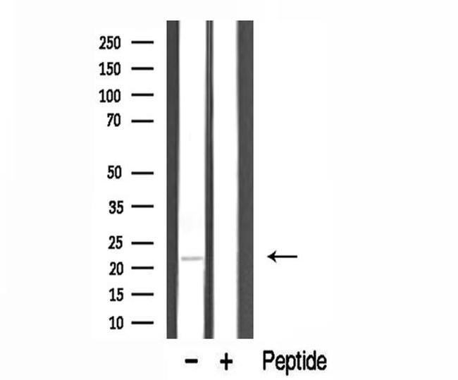 TUSC5 Antibody in Western Blot (WB)