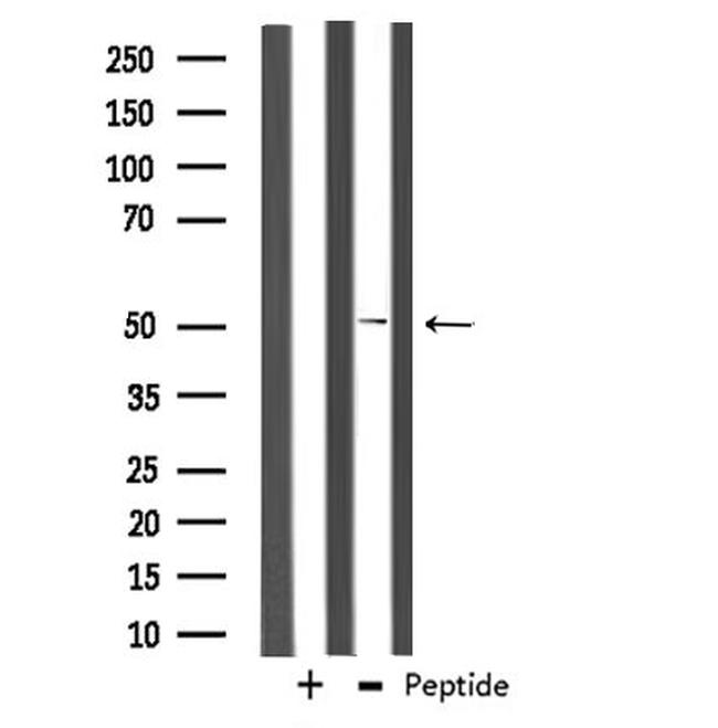 CABC1 Antibody in Western Blot (WB)