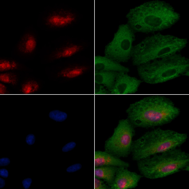 GTF3C2 Antibody in Immunocytochemistry (ICC/IF)