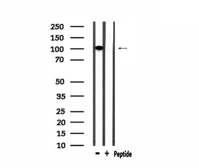 GTF3C2 Antibody in Western Blot (WB)