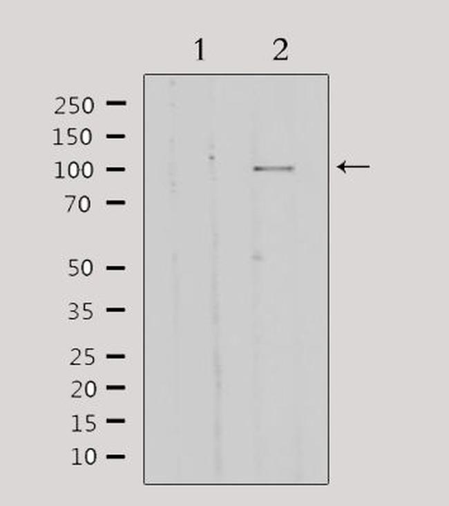 GTF3C2 Antibody in Western Blot (WB)