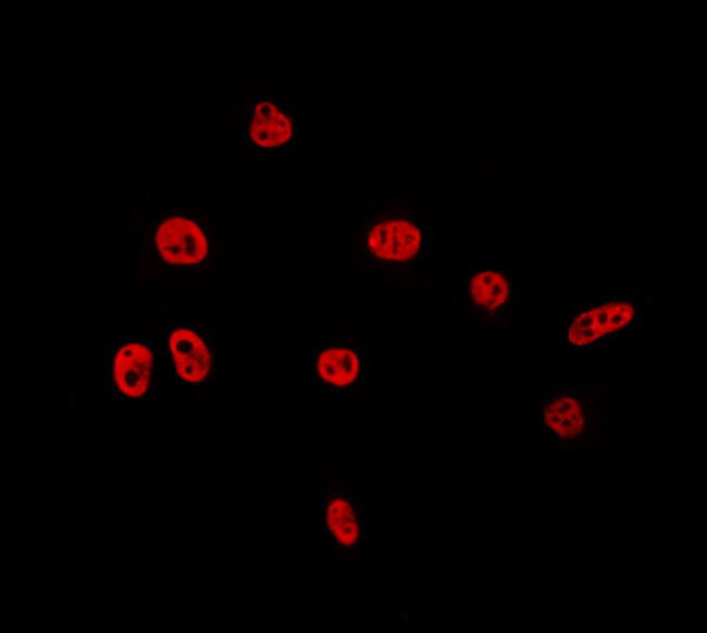 TAF15 Antibody in Immunocytochemistry (ICC/IF)