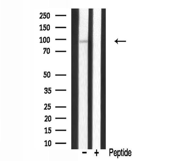 HPK1 Antibody in Western Blot (WB)