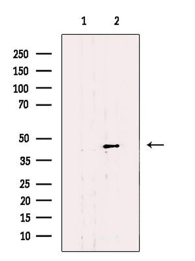 SLC22A18 Antibody in Western Blot (WB)