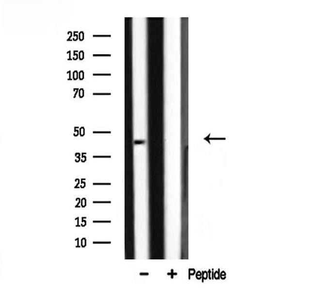 ILKAP Antibody in Western Blot (WB)