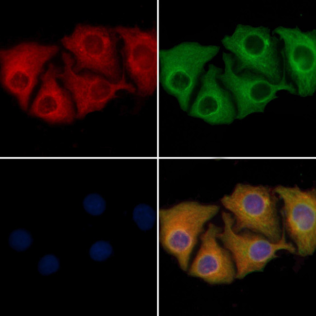 IARS2 Antibody in Immunocytochemistry (ICC/IF)