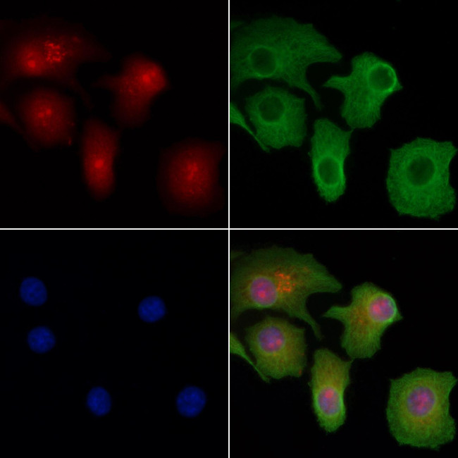 AATF Antibody in Immunocytochemistry (ICC/IF)