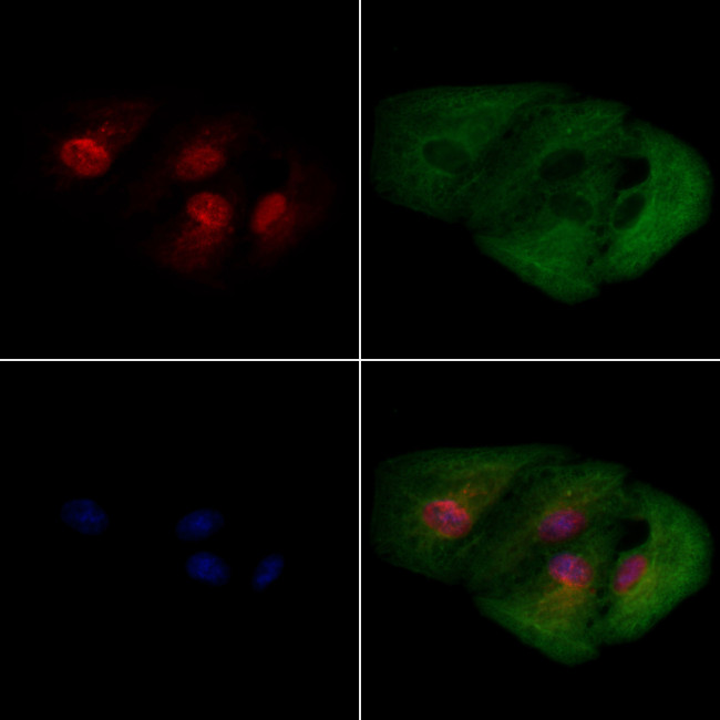 ZC3H7B Antibody in Immunocytochemistry (ICC/IF)