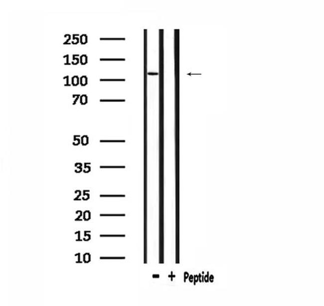 ZC3H7B Antibody in Western Blot (WB)