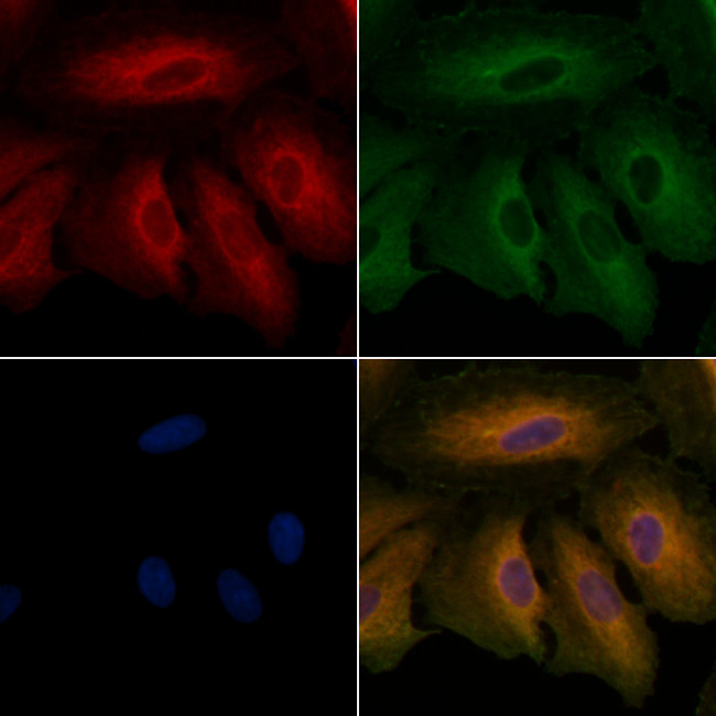 gamma Adducin Antibody in Immunocytochemistry (ICC/IF)