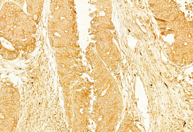 gamma Adducin Antibody in Immunohistochemistry (Paraffin) (IHC (P))