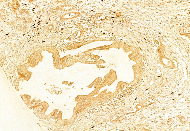 gamma Adducin Antibody in Immunohistochemistry (Paraffin) (IHC (P))