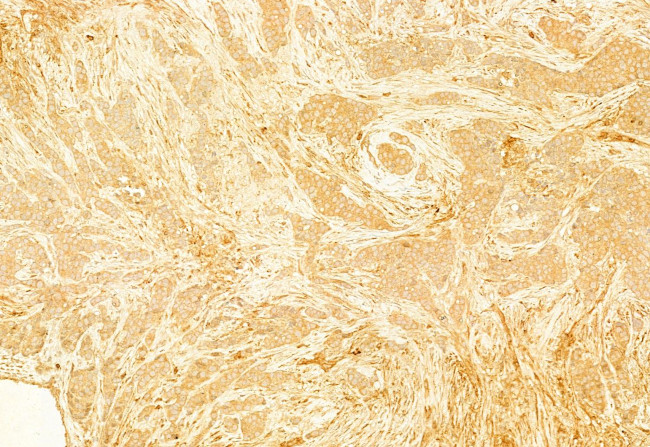 gamma Adducin Antibody in Immunohistochemistry (Paraffin) (IHC (P))