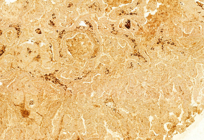 gamma Adducin Antibody in Immunohistochemistry (Paraffin) (IHC (P))