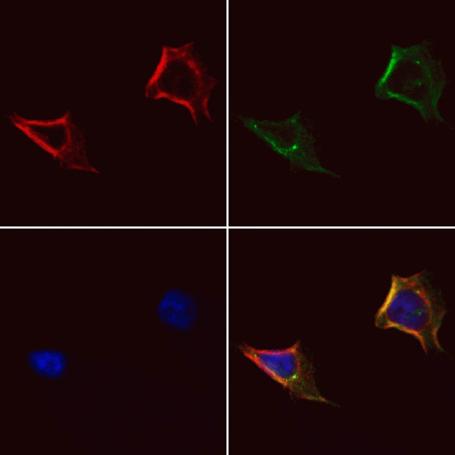 gamma Adducin Antibody in Immunocytochemistry (ICC/IF)