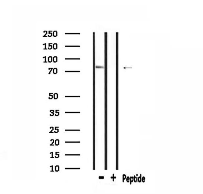 gamma Adducin Antibody in Western Blot (WB)