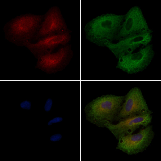 ARRDC3 Antibody in Immunocytochemistry (ICC/IF)